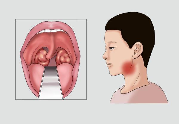 病毒侵略很可怕！进步免疫力火烧眉毛，每天一颗健旺体质